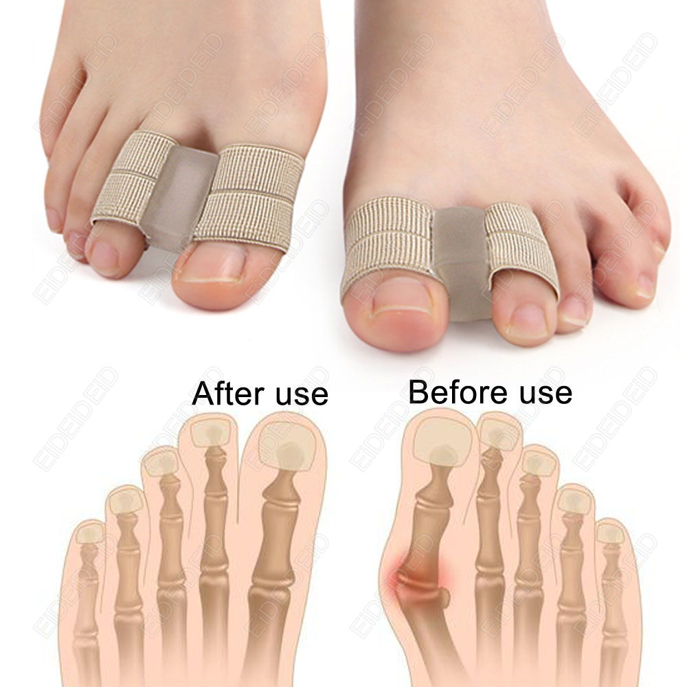 Bunion teen Corrector Orthesen - Women'S Shoes For Bunions recensie en prijs
